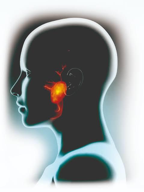 Tumores das Glândulas Salivares: Diagnóstico e Tratamento Atual