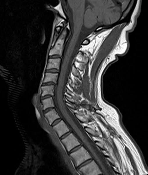 Exames de Imagem no Pescoço