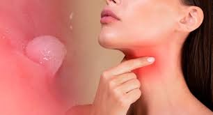 Entendendo a Relação Entre HPV e Câncer de Cabeça e Pescoço