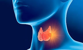 Fadiga no Tratamento do CâncerDiagnóstico Precoce do Câncer de Laringe: Sintomas e Exames Importantes