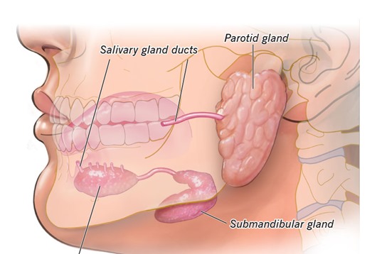 Nódulo na Parótida