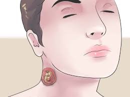 Nódulo dolorido no pescoço: causas comuns