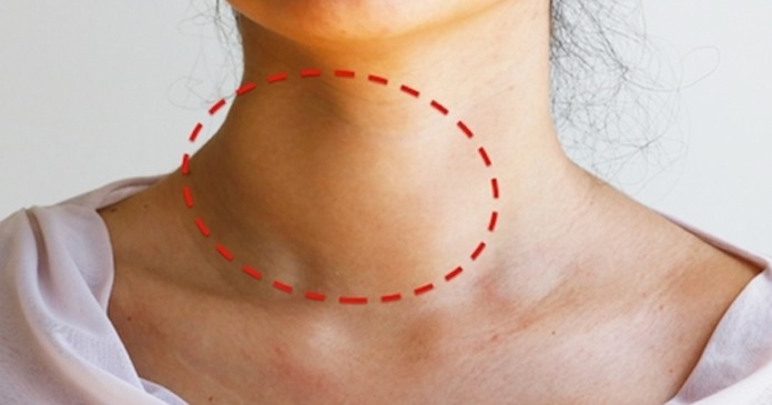 caroço pós-infecção
