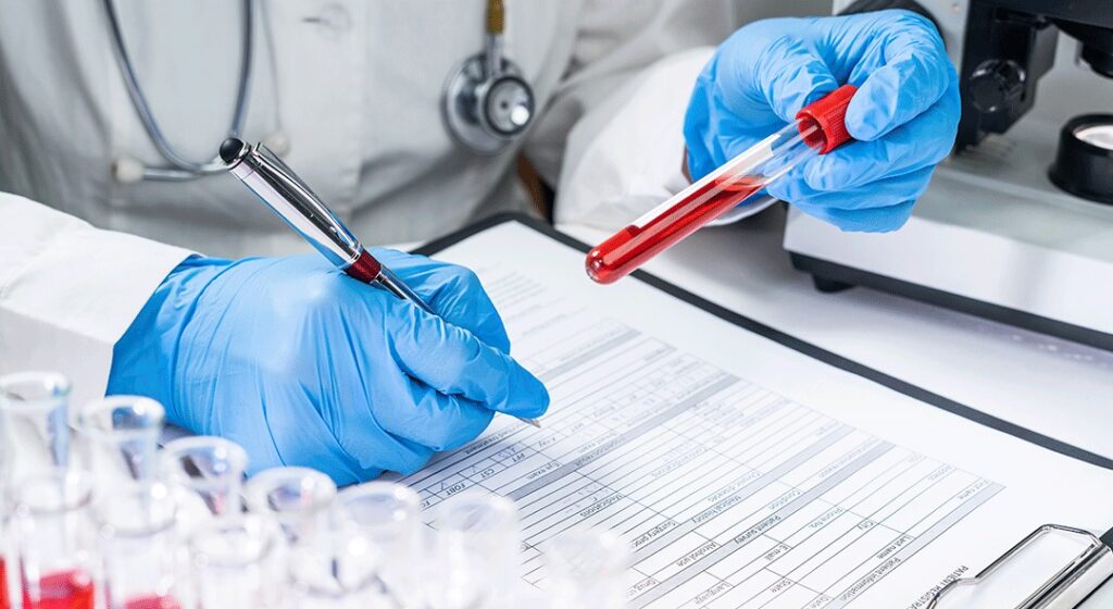 exame de sangue nódulo
