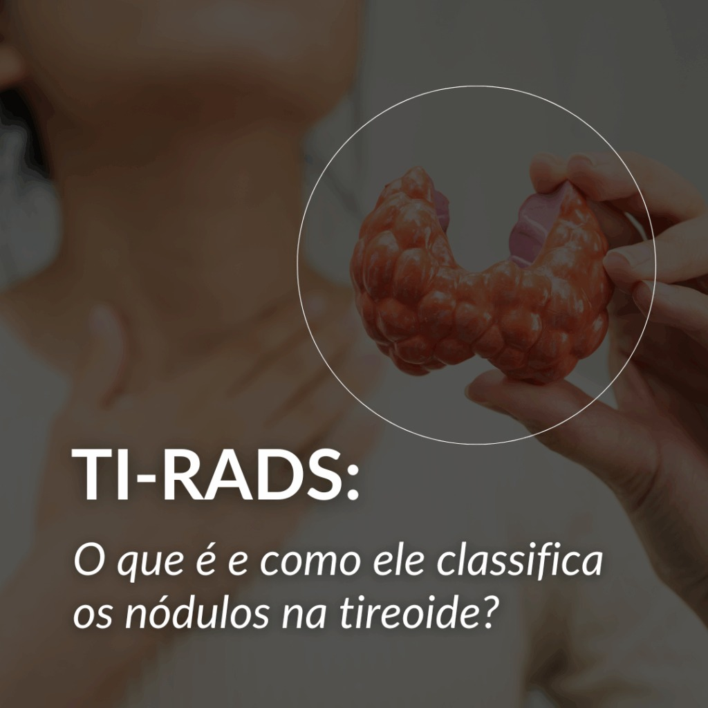 TIRADS 1