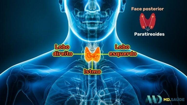 Tipos de Câncer de Tireoide
