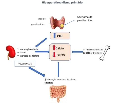 PTH Alto