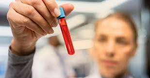 Exames de Sangue da Tireoide