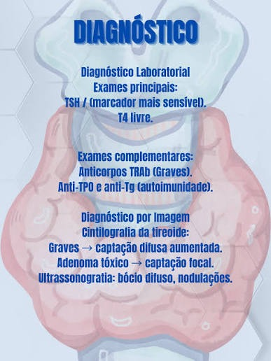 Hipertireoidismo